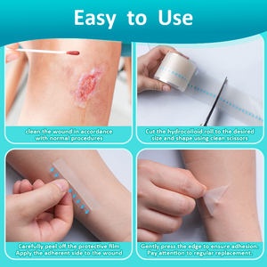 العلامة التجارية HDS لاصقة غروانية مائية ضمادات تضميد الجروح فائقة الامتصاص مقاومة للماء مرنة معقمة ذاتية اللصق نفطة حرق حب الشباب - Product Image 2