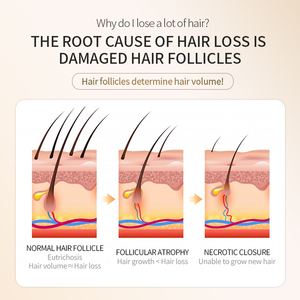 Tratamientos de Pigmentación <span class=keywords><strong>para</strong></span> <span class=keywords><strong>el</strong></span> Crecimiento del <span class=keywords><strong>Cabello</strong></span> Borala, los Mejores Productos <span class=keywords><strong>para</strong></span> <span class=keywords><strong>el</strong></span> Crecimiento Rápido del <span class=keywords><strong>Cabello</strong></span> Natural - Product Image 4