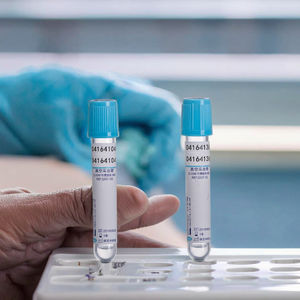 Klinik testler için 8ml PET cam kan testi tüpü EDTA taintainer vakum toplama örneği - Product Image 4