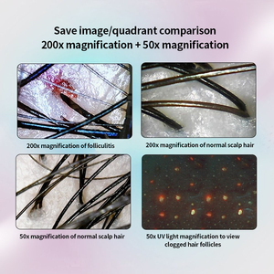 Détecteur de follicules pileux et de cuir chevelu portable 50X à 3 spectres, 10MP avec amplification 50x et 200x, détection trispectrale HD - Product Image 3