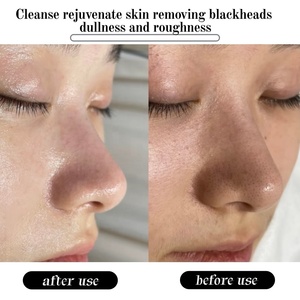 <span class=keywords><strong>Mascarilla</strong></span> <span class=keywords><strong>Exfoliante</strong></span> Iluminadora de Levadura de Azúcar Moreno con Adenosina, Elimina los Poros Obstruidos y los Puntos Negros, Limpieza Profunda y Renovación de la Piel - Product Image 2