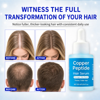 Serum Perawatan Rambut Copper Peptide dengan GHK-Cu, Kulit Kepala Tampak Lebih Tebal, Terasa Lebih Nyaman, Meningkatkan Penampilan Kepadatan/Kemurnian Rambut
