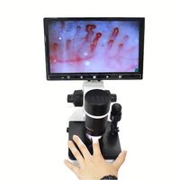 LCD Screen Microscope Detection Instrument Nailfold Video Finger Blood Callipary Capillaroscope Microcirculation Microscope