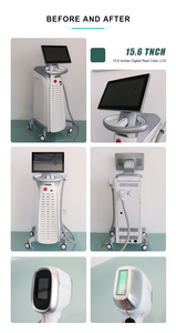 Producto de Tendencia 2026, Máquina de Depilación Láser de Diodo de 808nm, 4 Longitudes de Onda, Rejuvenecimiento de la Piel, Depilación, Dispositivo de Belleza 2026 - Product Image 4