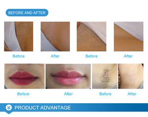 <span class=keywords><strong>Photon</strong></span> Hautverjüngungs-Gerät Desktop Soprano Schönheitsgerät Kommerzielles Multifunktionales All-in-One-Gerät Ultraschall Schnelle Haarentfernung - Product Image 6