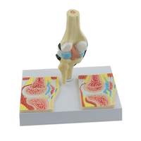 Modèle d'arthrite rhumatoïde du genou grandeur nature pour l'orthopédie humaine, vente en gros d'usine, science médicale, anatomie humaine
