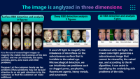 Analyseur de Peau Professionnel 12-en-1 Spectral Imaging Technologies : Machine d'Analyse Cutanée pour Points Noirs, Acné, Rides et Huiles 2026