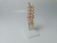 Modelo Anatómico Humano de Columna Vertebral con Vértebras Lumbares, Sacro y Coxis, y Hernia Discal, Tamaño Real, para Enseñanza Médica