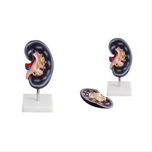 Modelo Anatómico de Riñón de 1 y 2 Partes para Demostración de Enfermedades, Herramienta de Enseñanza Médica, Modelo Médico - Product Image 1