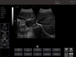 Ultrasone echografie-apparaat voor huisdieren, diagnostische ecograaf, digitale hart-echografie, zwart-wit PW-ultrasone scanner - Product Image 2
