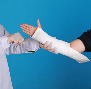 Attelle orthopédique en fibre de verre/polyester moulable pour premiers secours médicaux, protection respirante, fixation externe, prix d'usine - Product Image 3