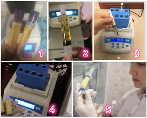 Machine à <span class=keywords><strong>Gel</strong></span> Plasma PPP Machine à <span class=keywords><strong>Gel</strong></span> Plasma de Remplissage <span class=keywords><strong>Bio</strong></span> - Product Image 3