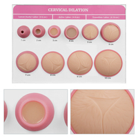 Ensemble de modèles de dilatation cervicale (10 pièces) avec support de présentation sur chevalet pour démonstrations en cours de sciences médicales Modèle CP.KC.0483 Marque OEM