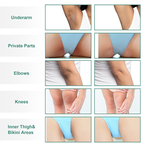 Crema Blanqueadora Corporal para Axilas, Piernas, Rodillas, Codos y Partes Íntimas, Aclara las Axilas, Elimina Manchas Oscuras, Cuidado de la Piel - Product Image 4