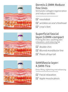 Appareil de lifting <span class=keywords><strong>du</strong></span> <span class=keywords><strong>visage</strong></span> et <span class=keywords><strong>du</strong></span> cou anti-âge, rajeunissement facial non invasif, appareil de resserrement de la peau - Product Image 5