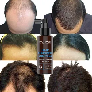 Private Label 100ML Natural Formula Anti Hair Loss Serum Hair Growth Spray Repair Hair Follicles
