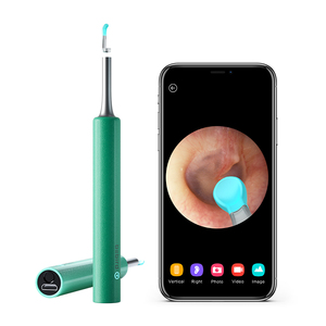 ¡Caliente para <span class=keywords><strong>mercado</strong></span> <span class=keywords><strong>libre</strong></span>! Inalámbrico oído otoscopio del endoscopio para iPhone iPad Android de la tableta del teléfono - Product Image 1
