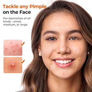 Medicali 5 taglie 404 bende idrocolloidi grande Acne <span class=keywords><strong>grandi</strong></span> <span class=keywords><strong>cerotti</strong></span> brufoli per corpo, schiena, viso, petto, <span class=keywords><strong>cerotti</strong></span> - Product Image 3