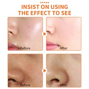 Nettoyant Visage Quotidien Doux Hydratant Anti-Acné Bio à la Vitamine C, Éclaircissant et Illuminateur, Marque Privée - Product Image 6