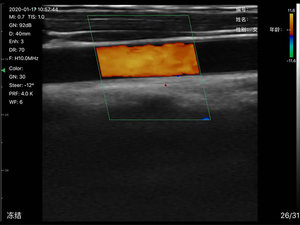 Sonde à ultrasons sans fil à double tête 80 éléments <span class=keywords><strong>3</strong></span> en 1 - Product Image 4