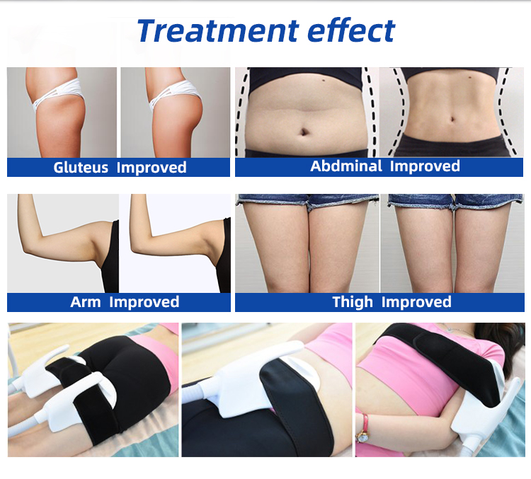 RF Ems Sculpting Cellulite Reduction Machine 13 Tesla Fitness Body Slimming Butt Lifter