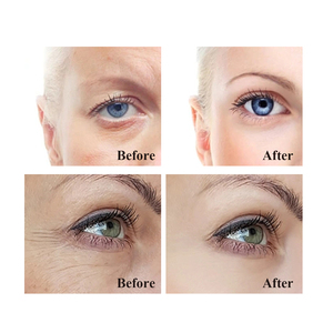 Crème pour les yeux raffermissante et revitalisante QBEKA, traitement pour les yeux à l'acide hyaluronique, éclaircissant et raffermissant pour les femmes, pour réduire les <span class=keywords><strong>cernes</strong></span> - Product Image 6