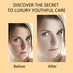 Huile Visage au Curcuma Marque Blanche, au Gingembre, Naturelle, Hydratante, Éclaircissante, <span class=keywords><strong>Anti</strong></span>-Âge, Soin Unifiant le Teint pour Femmes <span class=keywords><strong>Noires</strong></span>, Sérum Huileux pour Soins de la Peau - Product Image 4