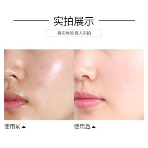 วิกร์นิซ เมคอัพ เซ็ตติ้ง พาวเดอร์ รีฟิล แบ็ก สีฟ้า คอนซีลเลอร์ เนื้อแมตต์ ระบายอากาศได้ดี - Product Image 2