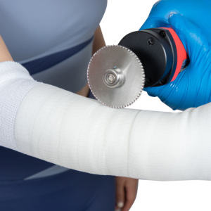 Free Sample Good Quality Medic Equipment Manufacturer Easy Operating White Injury Fiberglass <strong>Splint</strong> Casting Tape