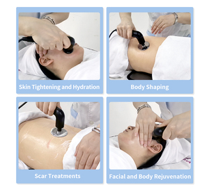 เครื่องอินดิบา เทคาร์ 448 กิโลเฮิรตซ์ สำหรับการเผาผลาญไขมันส่วนเกิน กระชับสัดส่วนด้วยคลื่นวิทยุ CET RET ความร้อนลึก ไดอะเทอร์มี เทคาร์ เครื่องเสริมความงาม - Product Image 2