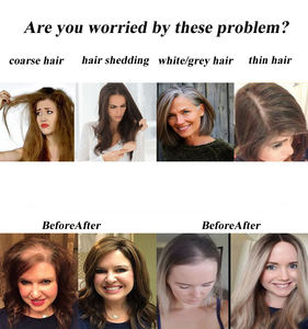 Entièrement tricoté à la main pour les <span class=keywords><strong>personnes</strong></span> atteintes de chimiothérapie ou d'alopécie du cancer, cheveux humains Remy Hair Woman Topper - Product Image 6