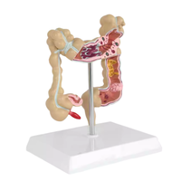 Modelo Anatómico de Intestino Grueso de PVC TIANLIAN YL-53, Maniquí Médico para Uso Escolar, Demostración de Aparato Intestinal Común