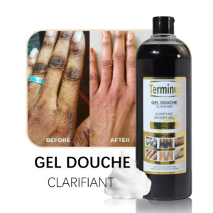 <span class=keywords><strong>Gel</strong></span> <span class=keywords><strong>de</strong></span> <span class=keywords><strong>Ducha</strong></span> Exfoliante y Blanqueador <span class=keywords><strong>de</strong></span> Marca Privada OEM Terminus para el Cuidado <span class=keywords><strong>de</strong></span> la Piel, Elimina las Manchas Negras - Product Image 3