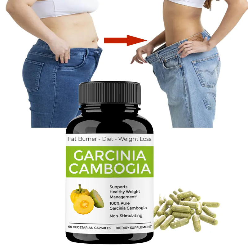 Private Label Natuurlijke Ondersteuning Gewicht Losse Energie Pure Garcinia Cambogia Extract Pil Garcinia Cambogia Afslankcapsules