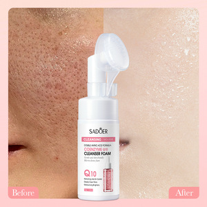 SADOER Mousse Nettoyante à la Coenzyme Q10, Mousse Nettoyante Douce aux <span class=keywords><strong>Double</strong></span> Acides Aminés, <span class=keywords><strong>Nettoyage</strong></span> en Profondeur, Contrôle du Sébum & Éclat de la <span class=keywords><strong>Peau</strong></span> - Product Image 6