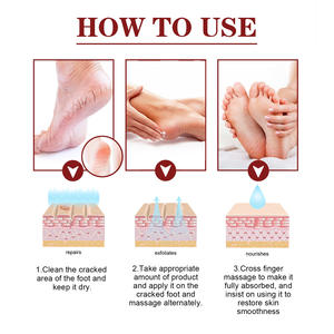 Vitamina E Anti Crack crema per i piedi olio Anti-asciugatura Crack crema per i piedi con tacco cracking crema per la riparazione rimozione pelle morta maschera per la cura dei piedi - Product Image 5