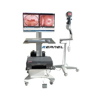 Kernel-Colposcopio de brazo voladizo, endoscopio tipo carro, colposcopia, ginecología, <span class=keywords><strong>Vagina</strong></span> - Product Image 2