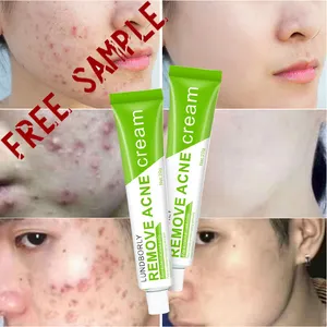 Pretty Cowry Natural Acne Treatment 100% Pure receive sample free products organic vegan Anti Acne Face Cream