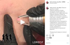 2025 Última tecnología láser de diodo de alta potencia 980nm máquina de tratamiento láser de venas varicosas/máquina de eliminación de venas vasculares de araña - Product Image 6