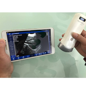 Escáner de sonda de ultrasonido B inalámbrico de matriz en fase convexa lineal de 80 elementos, instrumento veterinario para uso en hospitales/clínicas - Product Image 5