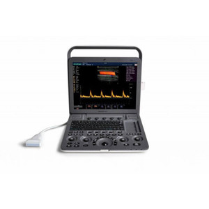 Échographe Doppler Couleur Portable SonoScape S9 Pro avec Batterie Intégrée pour Hôpital - Product Image 5