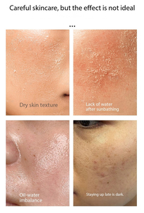 Hydra Dermabrasion Device With Suction Nano Spray Pore Cleansing Blackhead Removal Skin Rejuvenation System Hydration <b>Machine</b> - Product Image 5