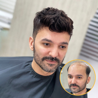 Prothèse capillaire Newtimes Hair pour hommes, en cheveux indiens Remy, avec base en dentelle flexible et contour en PU, système de perruque en cheveux naturels