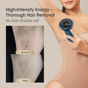 <span class=keywords><strong>Appareil</strong></span> d'<span class=keywords><strong>épilation</strong></span> IPL portable, épilateur permanent pour le visage et le corps, utilisation à domicile, système de refroidissement - Product Image 6