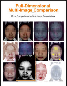 Analyseur de visage et de peau intelligent professionnel 2026, piloté par l'IA, 36 millions de pixels, imagerie 3D avec analyse multispectrale - Product Image 3