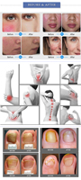 Nouvelle Tendance 2026 : Appareil de Nettoyage Facial 980nm pour l'Élimination des Varices et le Traitement des Veines d'Araignée du Visage