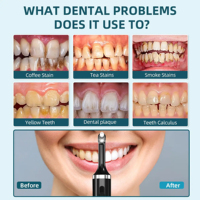 Nettoyeur de dents électrique sans fil professionnel polisseuse gomme dentaire dissolvant de tartre avec 5 têtes de brosse et 5 intensités de travail