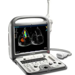 Macchina portatile di ultrasuono di Doppler di colore di ultrasuono S8 4d di Ecografo Sonoscape dell'ospedale