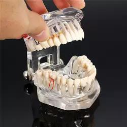 Modelo de dientes <span class=keywords><strong>para</strong></span> enseñanza Dental y entrenamiento - Product Image 6