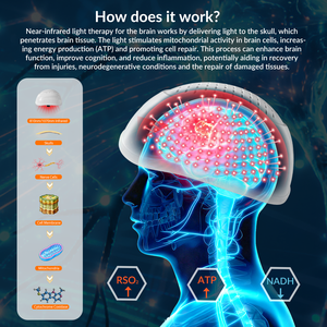 Casco de Terapia de Luz Roja de 810nm, Herramienta de Neurotratamiento con Infrarrojo Cercano para Demencia, Alzheimer, <span class=keywords><strong>Parkinson</strong></span>, Ansiedad y Depresión - Product Image 2